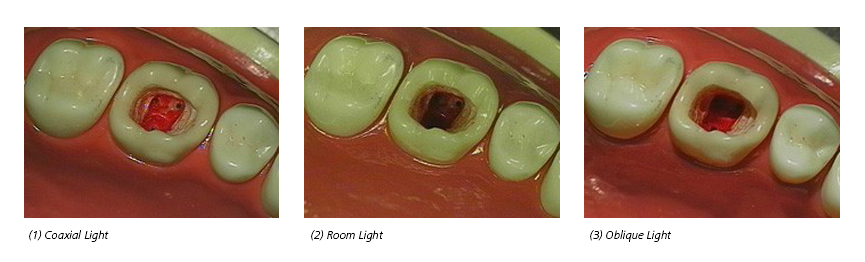 MeditecAG:/Dentistry/Other/Light source englisch.jpg